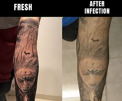 bad tattoo aftercare